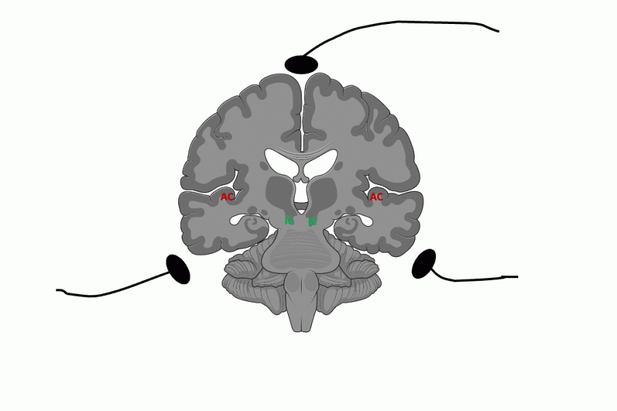 Spanlab Speech Processing and Auditory Neuroscience Laboratory – SPAN LAB – UW ...